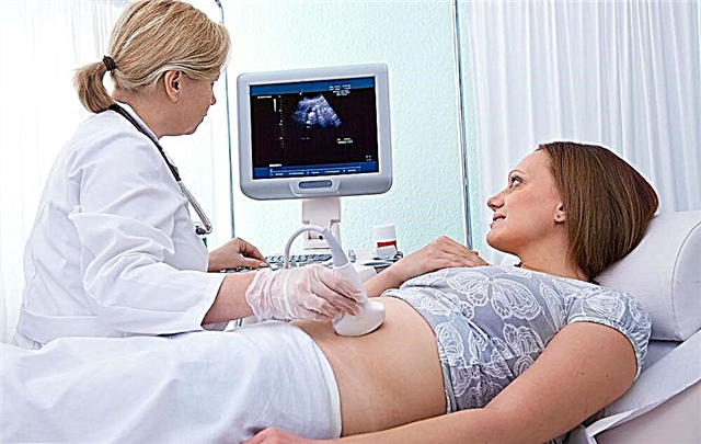 Echografie na 10 weken zwangerschap: grootte van de foetus en andere kenmerken