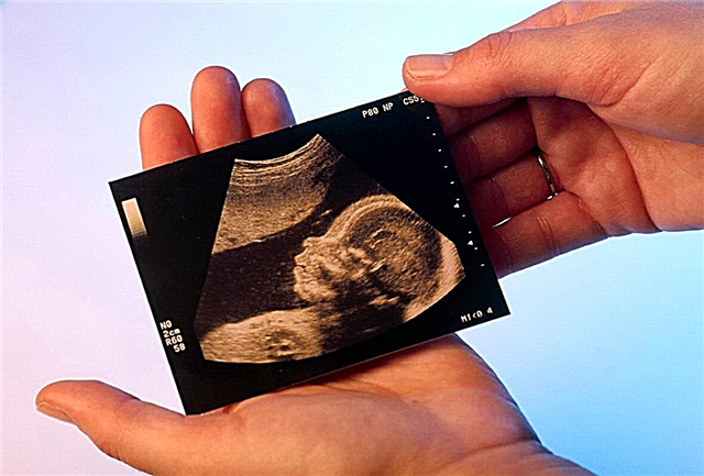 Echografie na 12 weken zwangerschap: grootte van de foetus en andere kenmerken