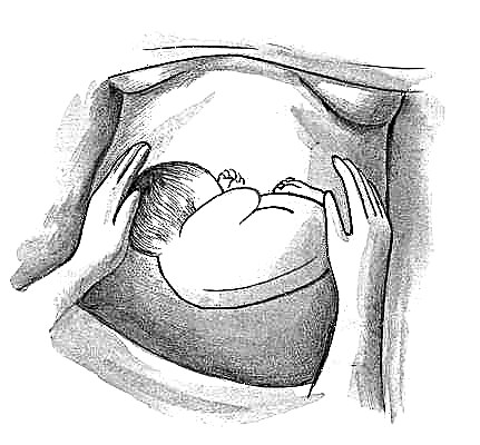 What does the lateral position of the fetus mean during pregnancy? 