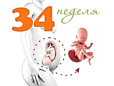 Развој фетуса у 34. недељи трудноће