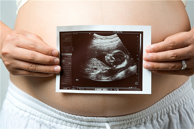 Ecografía a las 33 semanas de gestación: tamaño fetal y otras características