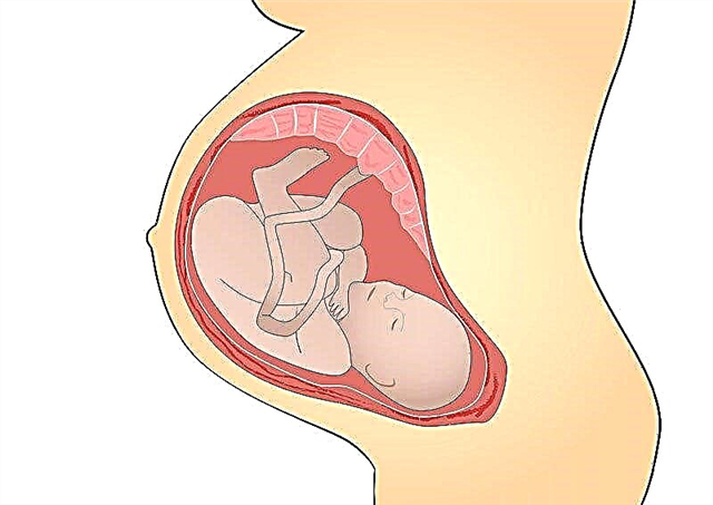 A rövid köldökzsinór terhességre és szülésre gyakorolt ​​hatásának jellemzői