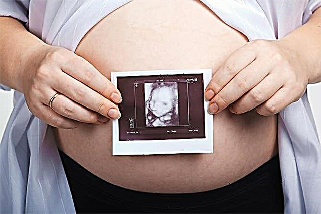 32. gebelik haftasında ultrason: fetal boyut ve diğer özellikler