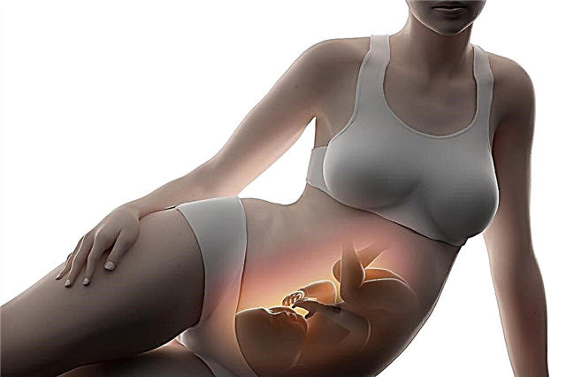 O que significa apresentação cefálica do feto durante a gravidez, como é e como está o parto?