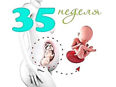 Vaisiaus vystymasis 35 nėštumo savaitę