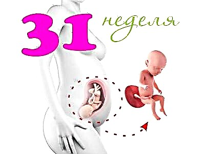 Vývoj plodu v 31. týždni tehotenstva