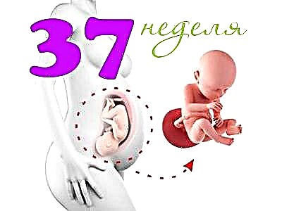 Vaisiaus vystymasis per 37 nėštumo savaitę