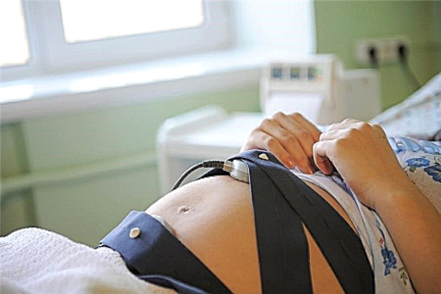 Декодиране на CTG по време на бременност