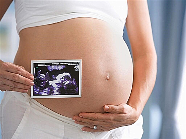 At what time is the third ultrasound done during pregnancy and what are the norms of indicators to be guided by?