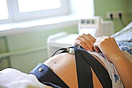 Norma valorilor CTG în timpul sarcinii