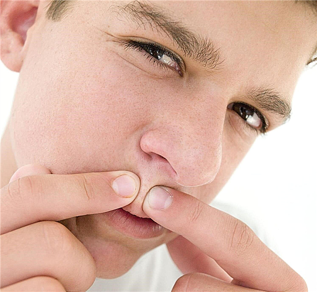 男の子の10代のにきびを治療する方法は？