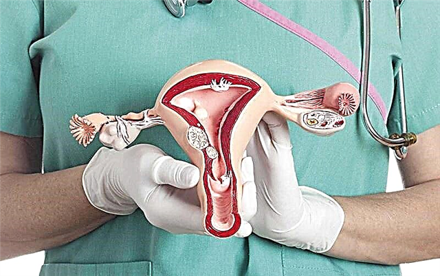 Totul despre foliculii din ovare