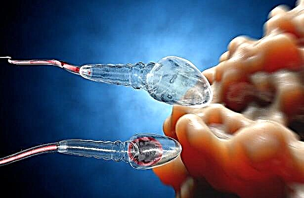 Kiek chromosomų turi spermos branduolys ir kokias ypatybes turi spermos chromosomų rinkinys?