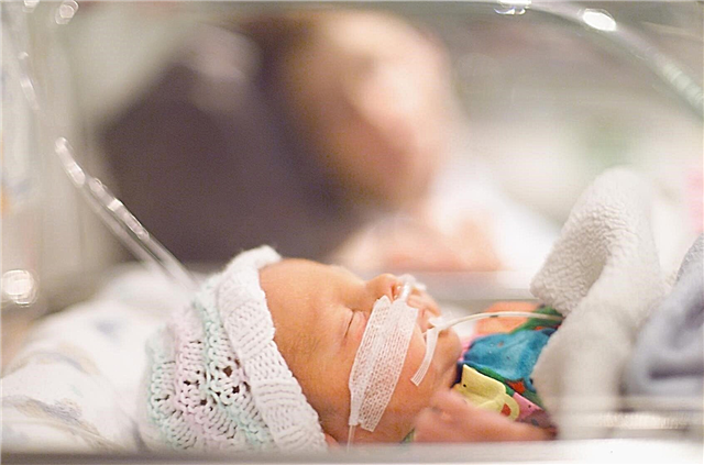 Loạn sản phế quản phổi ở trẻ sinh non
