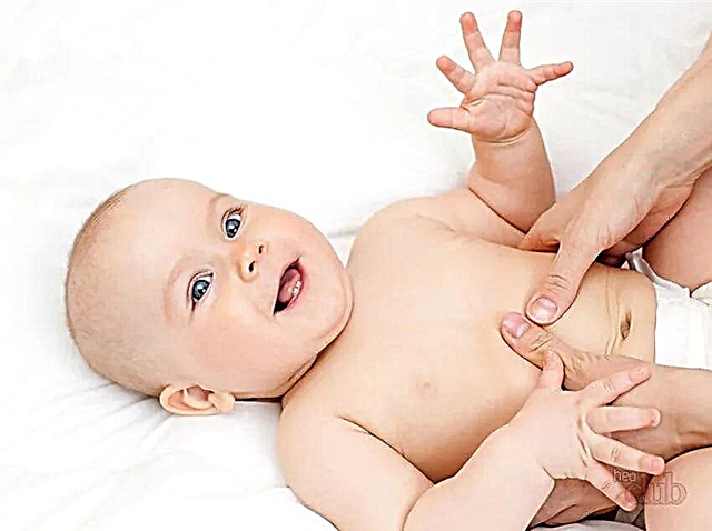 Navelstrenghernia bij pasgeborenen en zuigelingen
