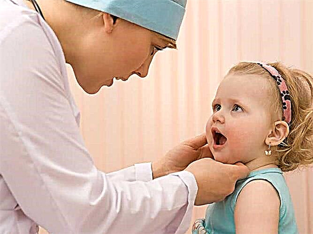 التهاب الفم عند الأطفال