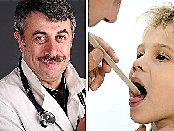 Liječnik Komarovsky o tome kako liječiti crveno grlo u djeteta