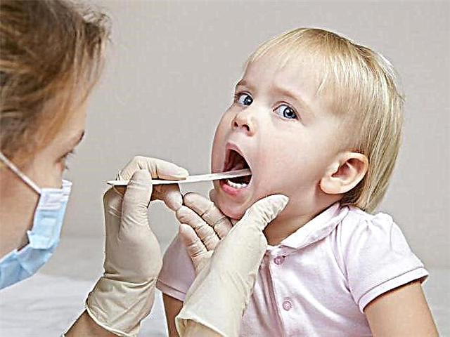 What to do if a child has a sore throat and how to treat it?