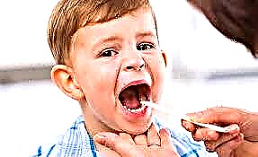¿Cómo se ve la garganta de un niño con faringitis?