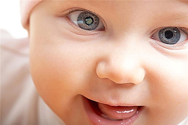 Çocuklarda doğuştan katarakt