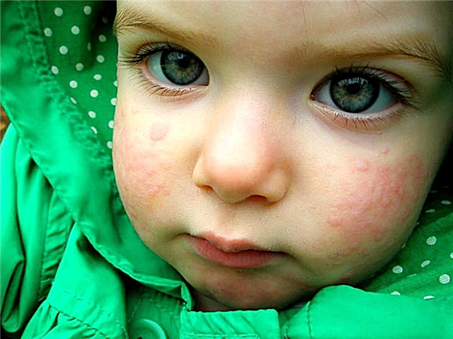 Hva skal jeg gjøre hvis et barn får utslett i ansiktet?