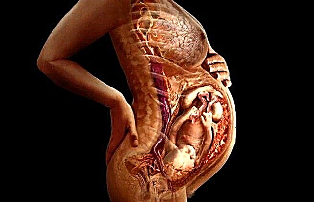 Causas de una placenta delgada durante el embarazo y las consecuencias de la hipoplasia.