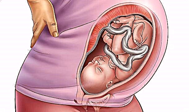 การนำเสนอทารกในครรภ์ต่ำในระหว่างตั้งครรภ์เป็นอย่างไรและเป็นอันตรายหรือไม่?