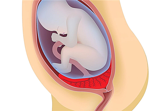 Position du placenta par rapport au pharynx interne