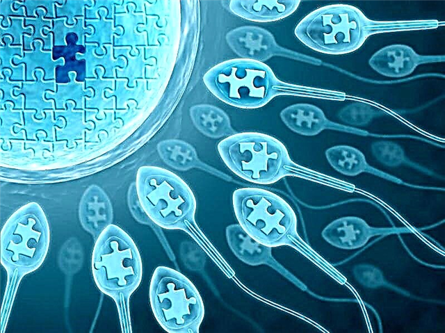 Що таке поліспермія і як вона впливає на зачаття?