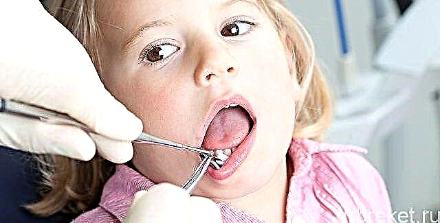 Psikosomatik penyakit periodontal pada orang dewasa dan anak-anak