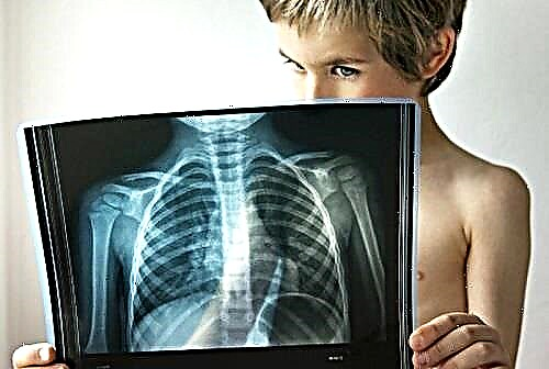 Psihosomatika pljučnih težav pri otrocih in odraslih