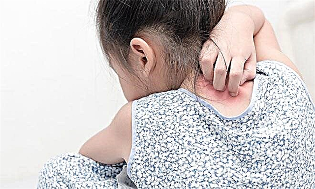 Psychosomatic causes of psoriasis in children and adults