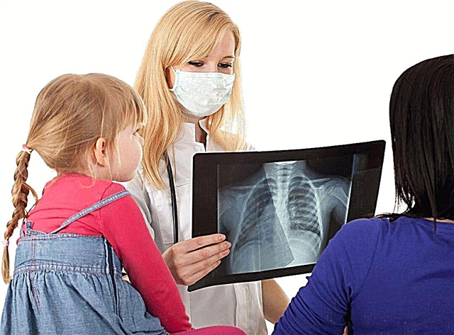 Symptome und Behandlung von Tuberkulose bei Kindern