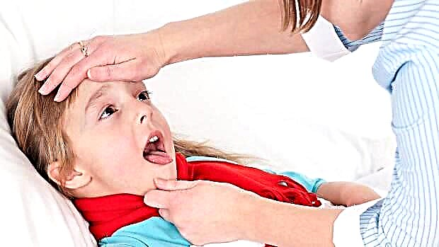 Herpes sore throat in children