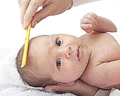 Себороични дерматитис код новорођенчади и новорођенчади