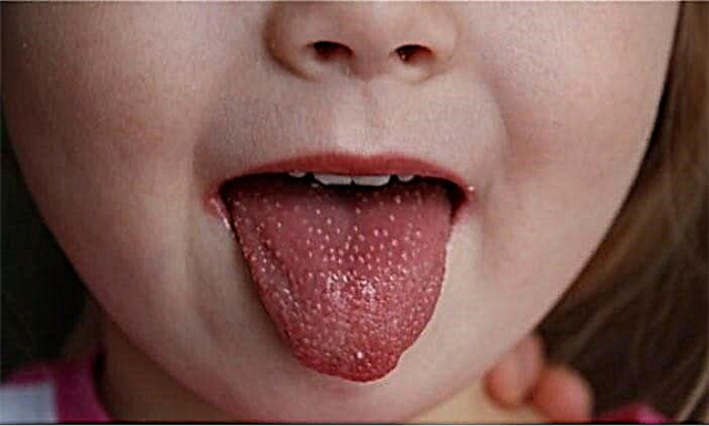 What to do if a child has a rash in the mouth?