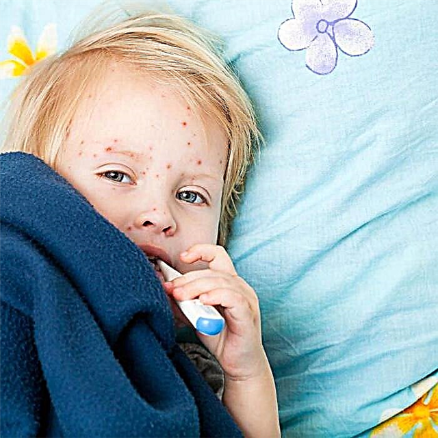 बच्चों में एंटरोवायरस संक्रमण के साथ एक दाने कैसा दिखता है?