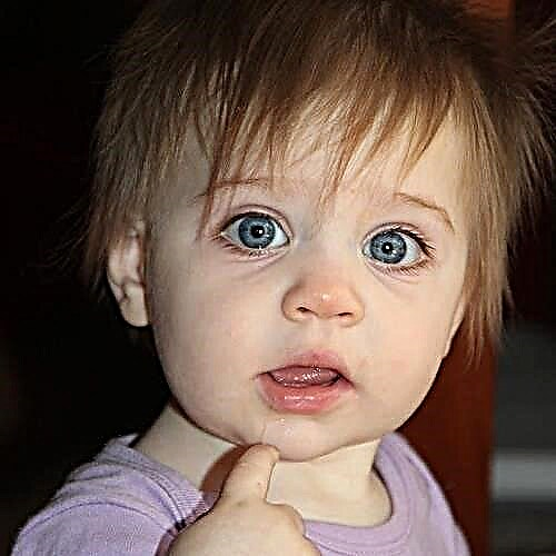 Anisocoria - verschiedene Pupillen bei einem Kind