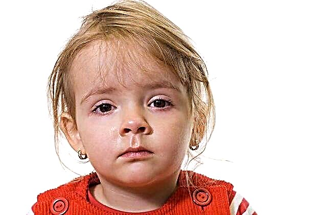 كيف تعالج التهاب الملتحمة عند الطفل من سن 1-4 سنوات؟