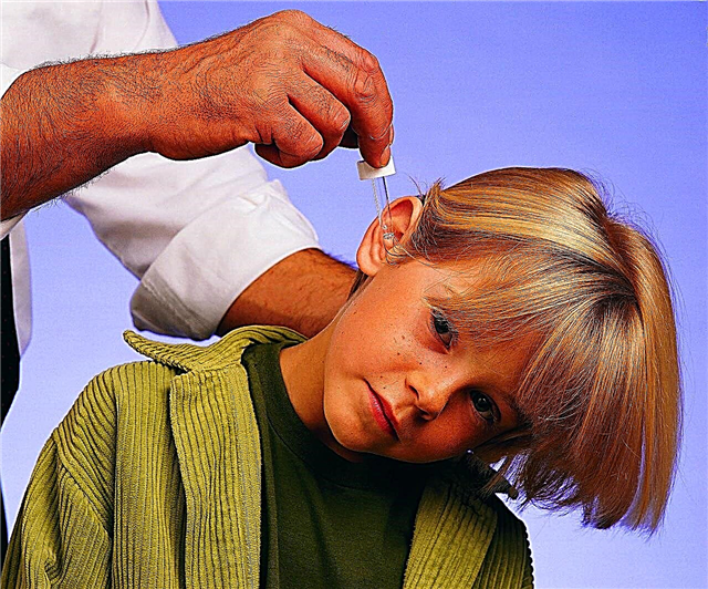 Apa yang harus dilakukan jika seorang anak memiliki sumbat belerang di telinganya?