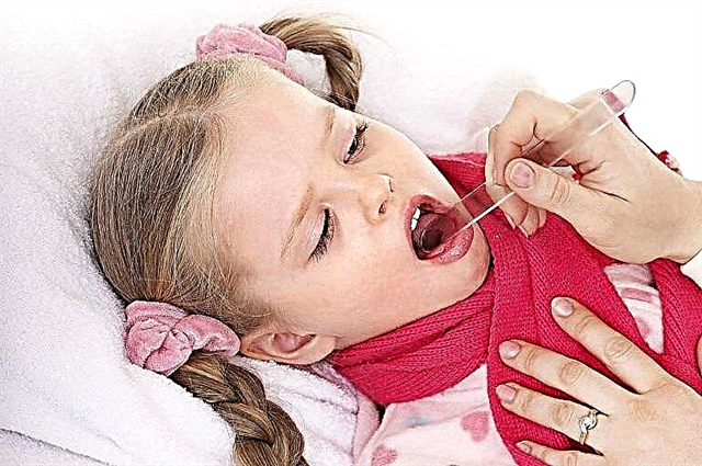 תסמינים וטיפול בדלקת גרון אצל ילדים
