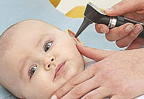 Symptoms and treatment of purulent otitis media in a child