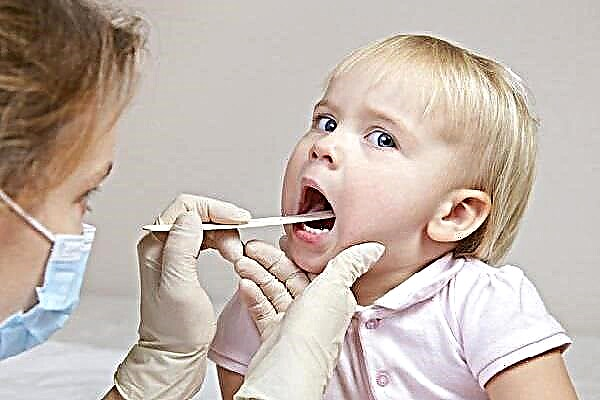 Symptomer og behandling av purulent sår hals hos barn hjemme