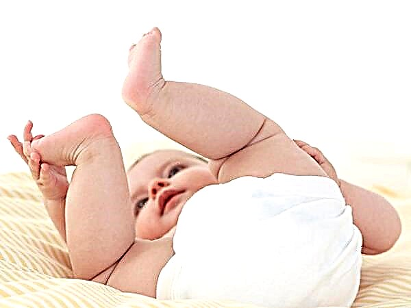 Naujagimių ir kūdikių klubo sąnario displazija