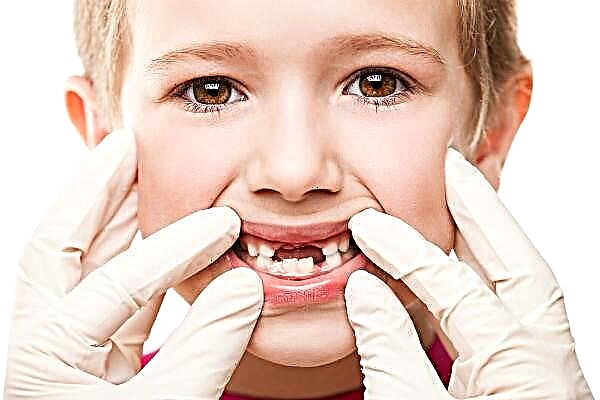Frequent gum problems in children