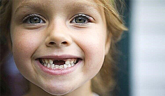 Que tipo de dente as crianças mudam?