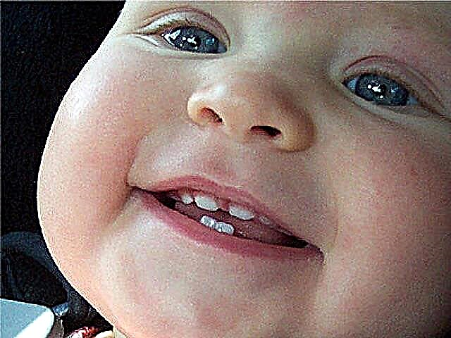 Зъбите на детето се катерят: симптоми
