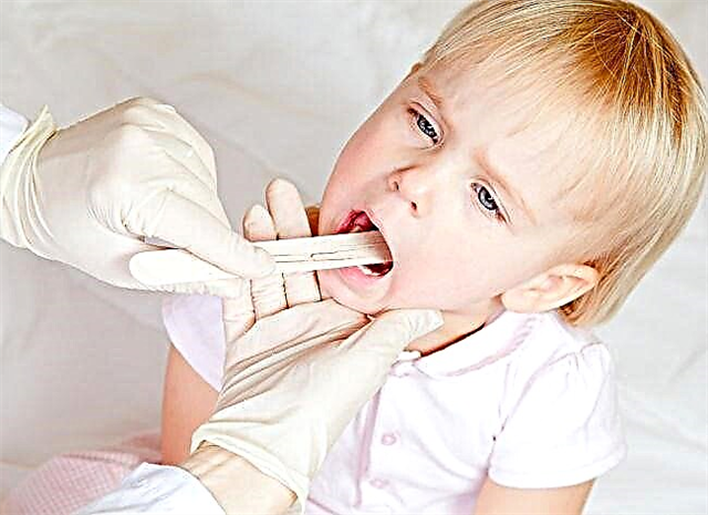 Hogyan kezeljük a szájgyulladást gyermekeknél?