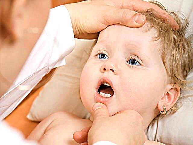 Estomatite aftosa em crianças e seu tratamento