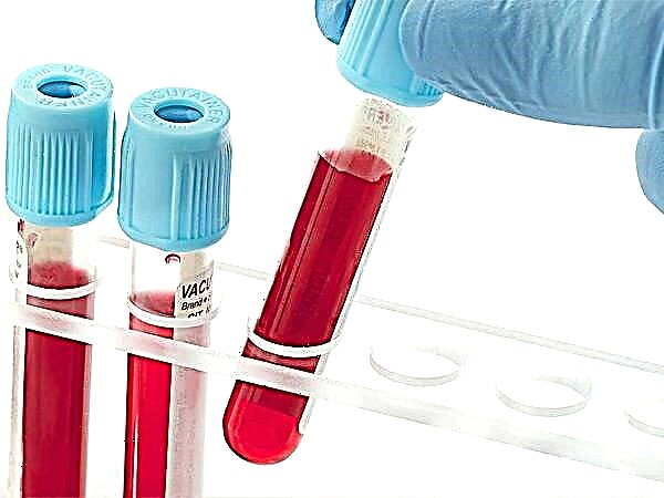 Mengenai pewarisan kumpulan darah. Kumpulan darah apa yang akan dimiliki oleh kanak-kanak itu?